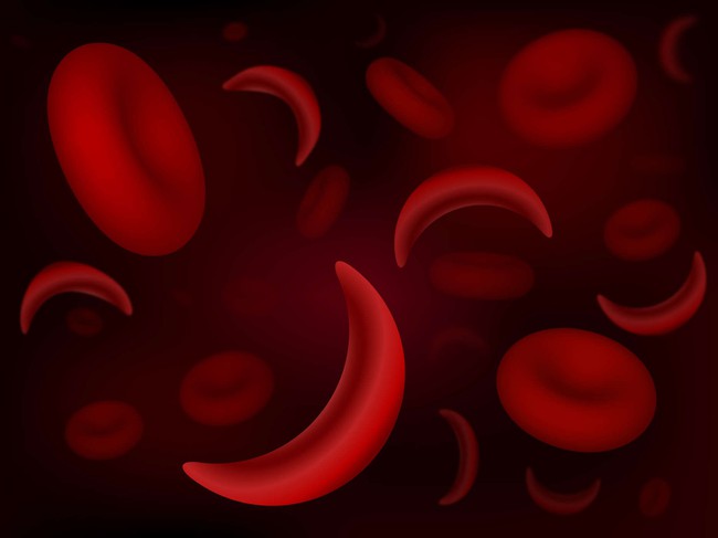 10 căn bệnh về máu thường gặp và dấu hiệu điển hình - Ảnh 2.