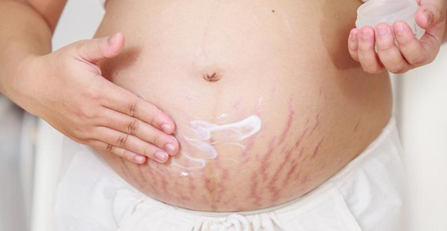 Muốn chữa viêm da cơ địa ở phụ nữ có thai tuyệt đối không được bỏ qua những phương pháp này - Ảnh 3.