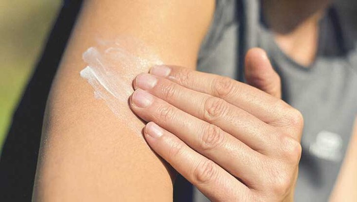Bệnh Lupus ban đỏ trầm trọng hơn khi nắng nóng gay gắt: Hiểu sao cho đúng? - Ảnh 4. Bệnh Lupus ban đỏ trầm trọng hơn khi nắng nóng gay gắt: Hiểu sao cho đúng? - Ảnh 4.