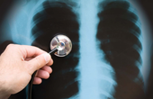 Ứng dụng X-Quang và CT-Scaner trong chẩn đoán bệnh phổi tắc nghẽn mãn tính (COPD)