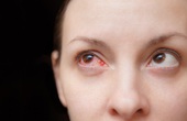 Những kiến thức cần biết về thuốc điều trị đau mắt đỏ ở phụ nữ mang thai?