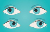 Tổng hợp các bài tập yoga cho mắt sáng khỏe để phòng tránh bệnh đau mắt đỏ