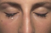 Chảy nước mắt sống là gì? Chảy nước mắt sống có phải làm dấu hiệu của bệnh đau mắt đỏ không?