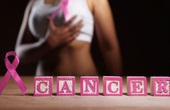 Tuổi tác có liên quan đến khả năng mắc bệnh Ung thư vú hay không?