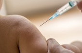 Cách giảm tác dụng phụ sau tiêm phòng vaccine thủy đậu