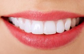 Mẹo làm đẹp: Mách bạn cách làm trắng răng tại nhà hiệu quả nhất