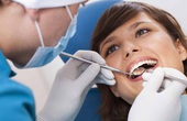 Tìm hiểu về tiểu phẫu nhổ răng khôn: Có đau không? Bao lâu thì lành?