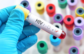 HIV có lây qua nước bọt không? HIV lây nhiễm qua con đường nào?