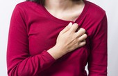 Những điều cần biết về hội chứng QT kéo dài, tình trạng có thể gây đột tử tim