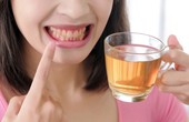 9 thực phẩm và đồ uống khiến răng bị ố vàng