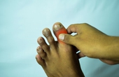 Đau nhói ở ngón chân cái như bị kim châm là bệnh gì?