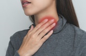 Đau một bên họng là bệnh gì? Có nguy hiểm không?