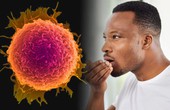 4 kiểu hôi miệng là dấu hiệu cảnh báo bệnh ung thư, khám ngay kẻo muộn!
