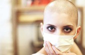 Tác dụng phụ của các phương pháp điều trị ung thư buồng trứng bệnh nhân cần lưu ý