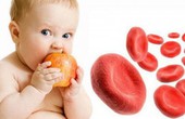 Bệnh tan máu bẩm sinh ở trẻ em: Dễ bị nhầm với bệnh thiếu máu