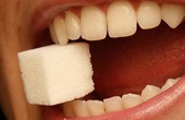 Những nguyên nhân sâu răng ít người biết
