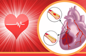 Nhồi máu cơ tim là gì? Chớ coi thường 10 dấu hiệu sau đây của nhồi máu cơ tim