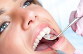 Vôi răng là gì? Ảnh hưởng của vôi răng đến sức khỏe răng miệng