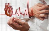 Phân loại viêm cơ tim: viêm cơ tim tự phát, do virus và do nhiễm trùng