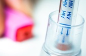 Sau vụ cắt đôi que thử của bệnh viện Xanh Pôn: Tự mua que test viêm gan B, HIV tại nhà liệu có chính xác?