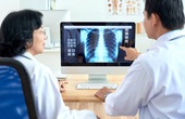 Chụp X-quang trong chẩn đoán hen suyễn: vai trò và quy trình thực hiện