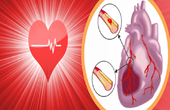 Bệnh thiếu máu cơ tim là gì? Dấu hiệu, nguyên nhân và cách điều trị