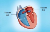 Bệnh tim bẩm sinh là gì? Tìm hiểu chung về bệnh tim bẩm sinh