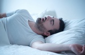 Hội chứng ngừng thở khi ngủ là gì? Cách phát hiện và điều trị bệnh sớm tránh nguy cơ tử vong