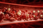 Xơ gan gây giảm tiểu cầu: Mối nguy hiểm khôn lường cho sức khỏe
