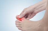 Tìm hiểu về cơ chế gây ra bệnh gout và các nhóm bệnh gout thường gặp