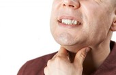 Đau họng - Dấu hiệu ung thư amidan sớm nhưng dễ bị bỏ qua