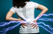Kiểm soát tốt các cơn đau lưng cấp tính nhờ nắm rõ dấu hiệu bệnh