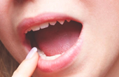 2 sai lầm thường gặp khi vệ sinh răng miệng cho bệnh nhân ung thư lưỡi 