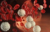 Tìm hiểu 3 nguyên nhân gây ung thư máu