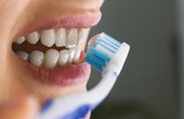Gợi ý cách chăm sóc răng miệng cho bệnh nhân ung thư thực quản