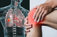 Ung thư phổi trẻ hóa, ghi nhớ ngay cách nhận biết 4 dấu hiệu ung thư phổi ở chân dễ bị bỏ qua