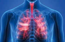 Hướng dẫn phân biệt bệnh phổi tắc nghẽn mãn tính (COPD) và khí phế thũng