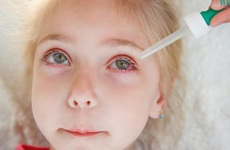 Chăm sóc trẻ bị đau mắt đỏ như thế nào mới đúng cách?