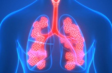 Tiêm phòng vắc-xin trong phòng tránh bệnh phổi tắc nghẽn mãn tính (COPD)