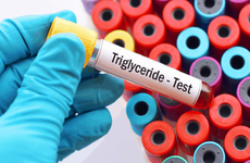 Những vấn đề ảnh hưởng đến sức khỏe khi chỉ số máu Triglyceride tăng cao trong cơ thể?