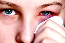 Điểm mặt 4 sai lầm khi điều trị đau mắt đỏ cần tránh