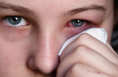 Những hiểu lầm về bệnh đau mắt đỏ có thể khiến bệnh trầm trọng hơn