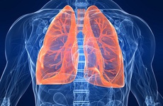 Tìm hiểu những nguyên nhân gây bệnh phổi tắc nghẽn mãn tính (COPD)