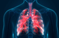 Từ A - Z về bệnh phổi tắc nghẽn mãn tính giai đoạn 4 (giai đoạn nặng)