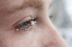 Tìm hiểu phương pháp điều trị và ngăn ngừa tình trạng khô mắt vào mùa đông