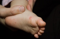 Chuyên gia y tế ‘mách’ cha mẹ cách tự kiểm tra bệnh tay chân miệng tại nhà cho trẻ cực đơn giản!