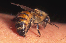 Nhiều người bị ong đốt gây sốc phản vệ nguy hiểm, cần làm gì khi bị ong đốt?