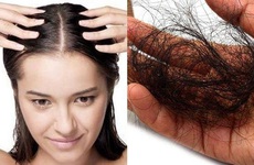 Rụng tóc: Nguyên nhân và cách ngăn ngừa rụng tóc