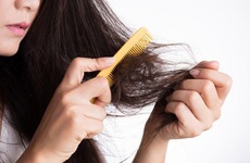 Sử dụng thuốc xịt tóc khiến nữ sinh viên rụng tóc