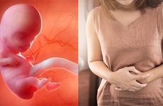 Lưu thai là gì? Nguyên nhân và dấu hiệu chết thai lưu
